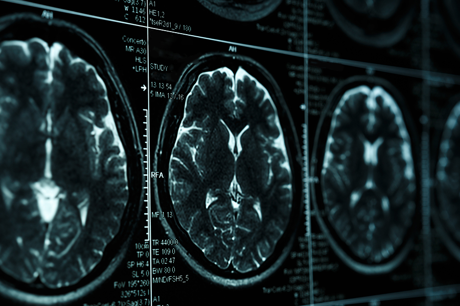 Neuroscience of selling